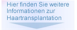 Informationen zur Haartransplantation